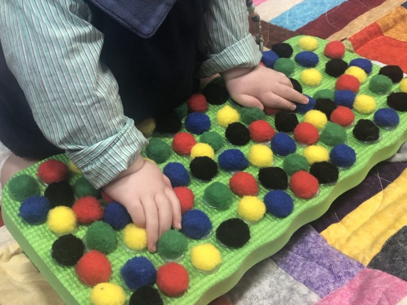 Where are we with his Arthrogryposis?